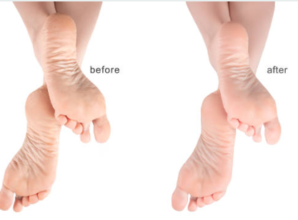 Transform Your Feet, Boost Your Confidence!